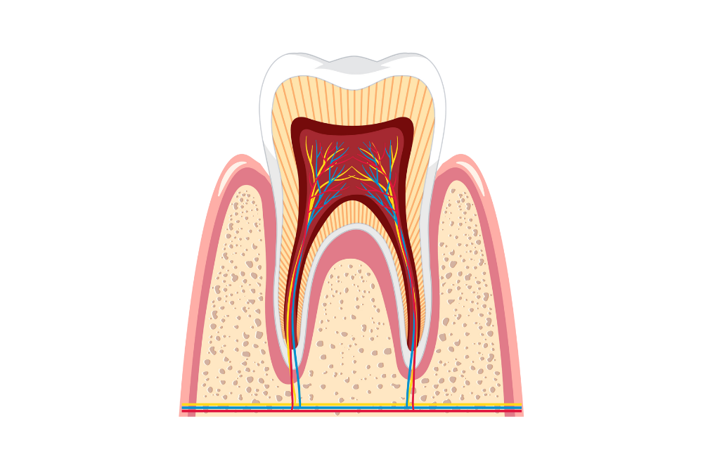 Root Canal