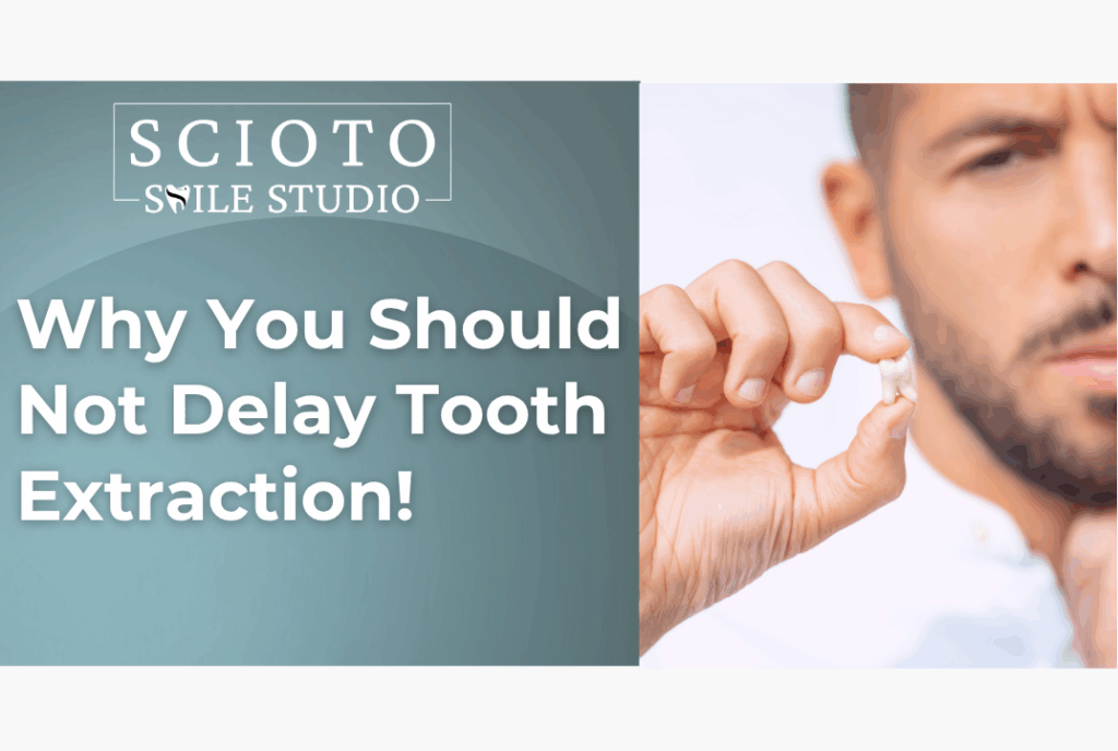 Why You Should Not Delay Tooth Extraction