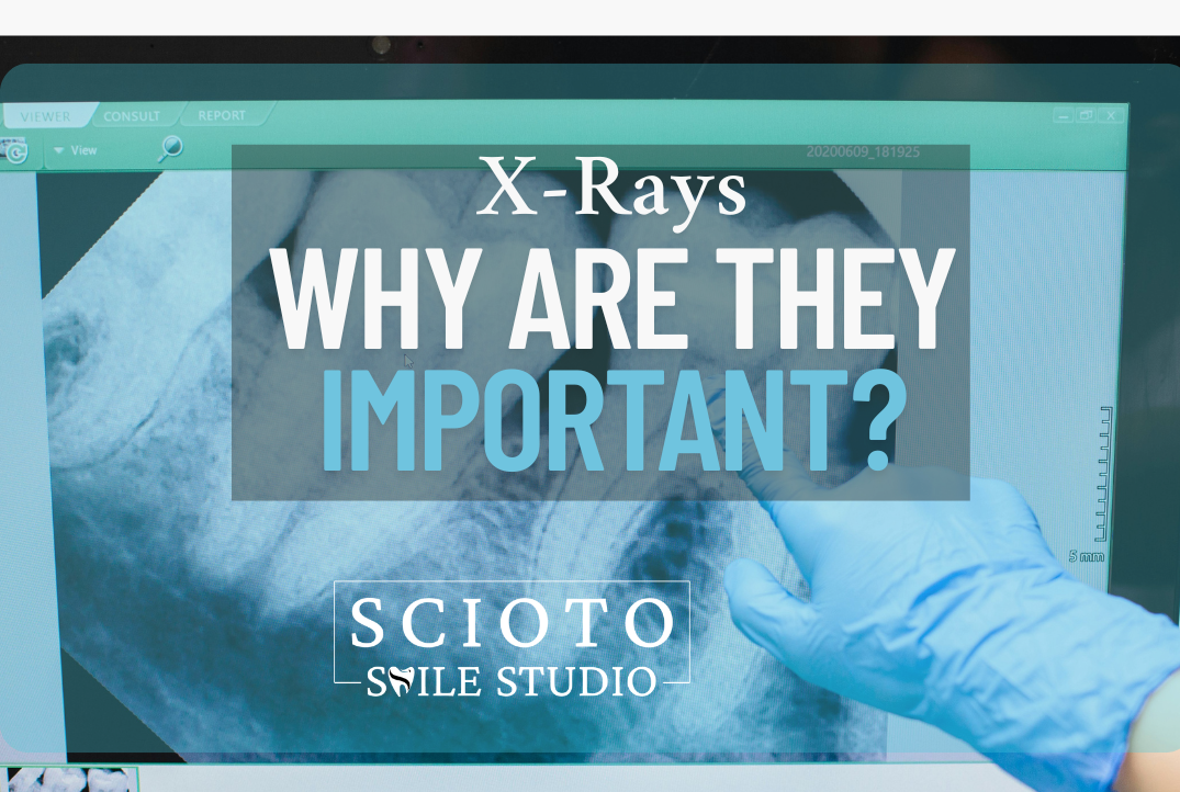 The Importance of Dental X-Rays: A Vital Step in Professional Dental Care